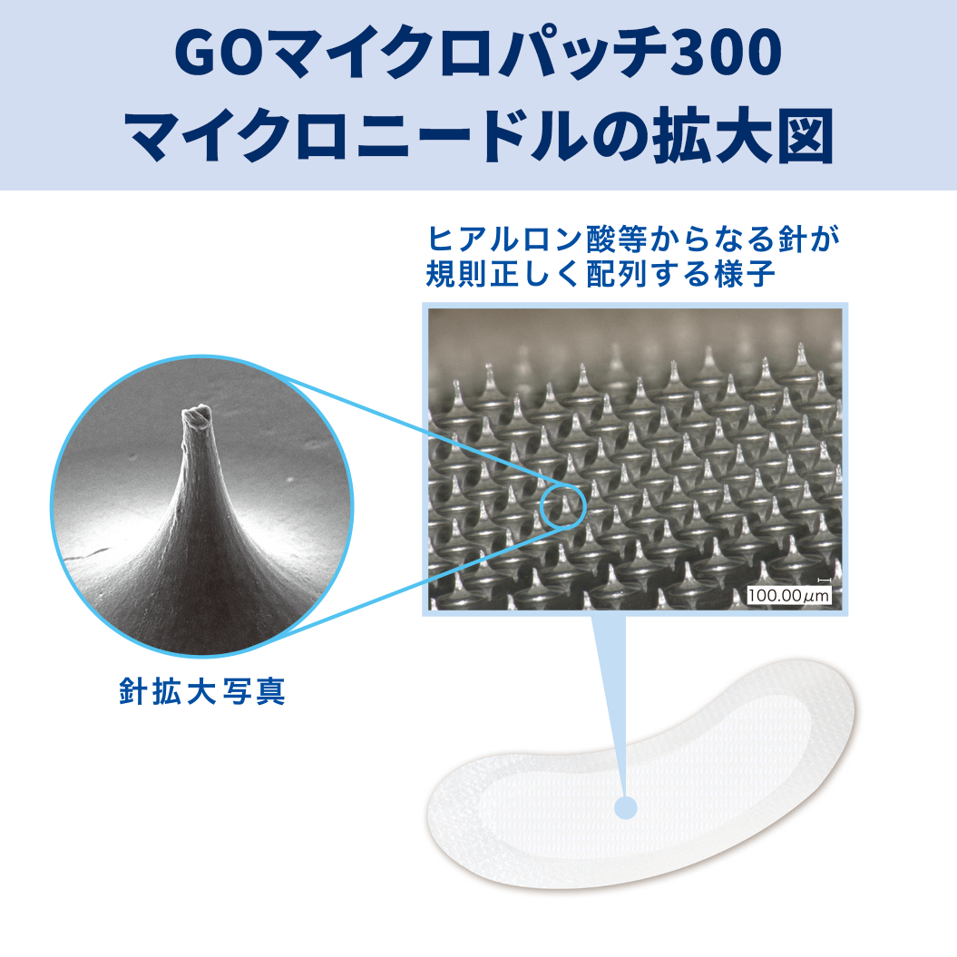 アイティーオー GOマイクロパッチ300